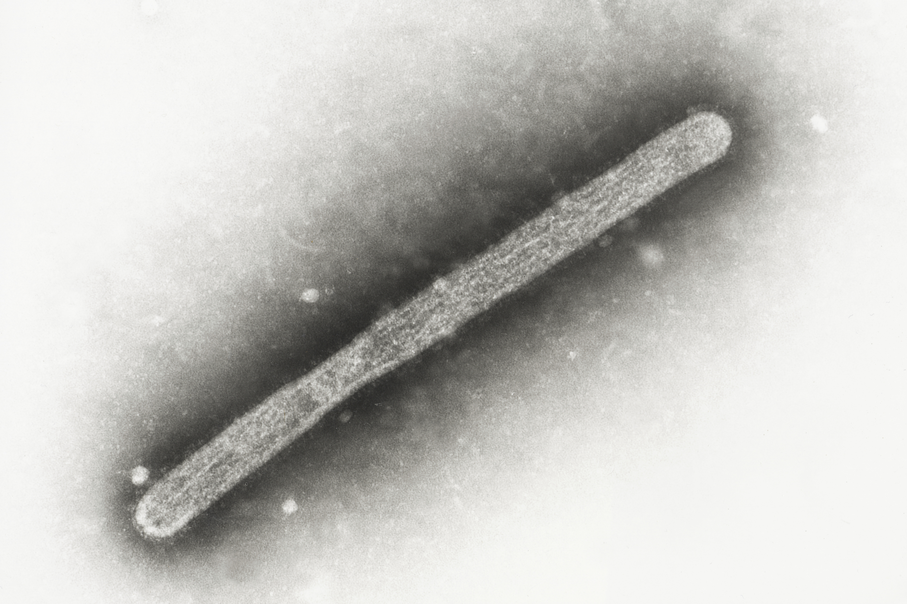 microscope image shows an avian influenza A H5N1 virion.