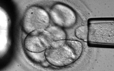 A single cell is removed from a human embryo to be used in generating embryonic stem cells for scientific research