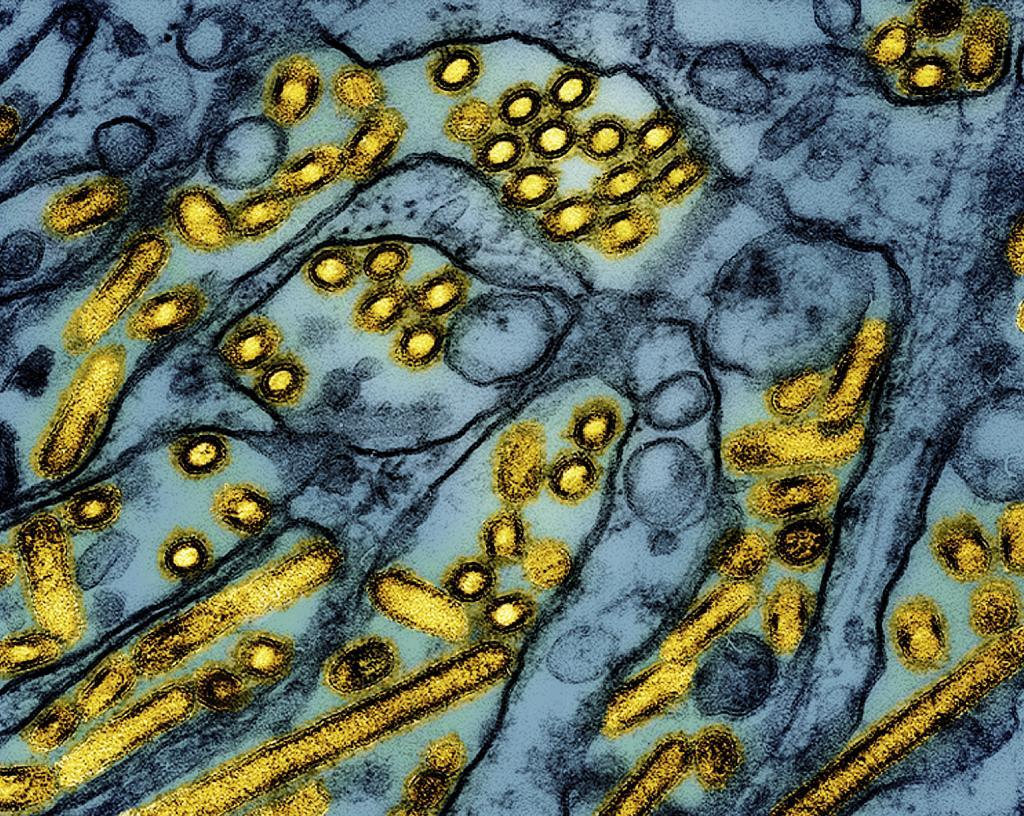 Avian influenza A H5N1 virus particles (yellow)