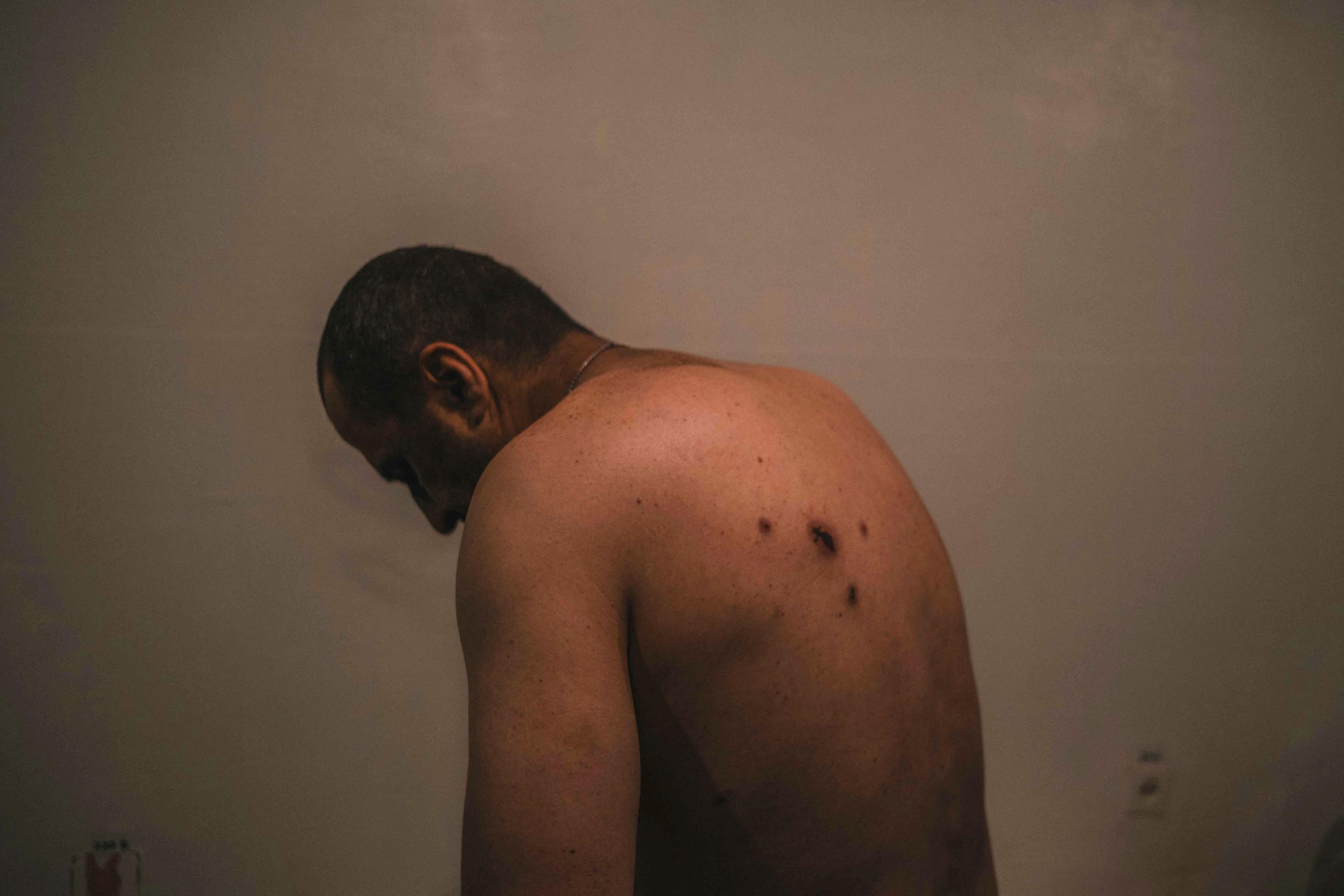 Olec, injured in the back by a drone.