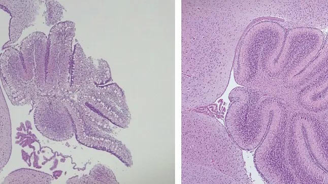 Differences between a mouse cerebellum treated with the experimental therapy (on the right) and one untreated.