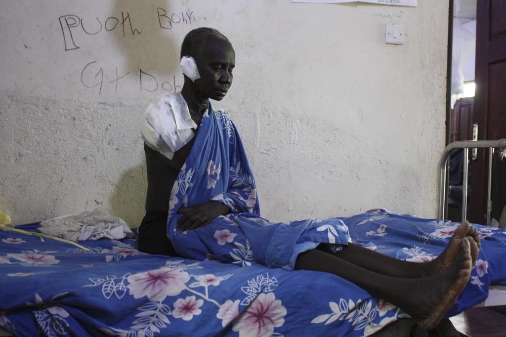 Wiyuach Makuach, 60, who lost her arm in an airstrike on a hospital operated by Doctors Without Borders (MSF