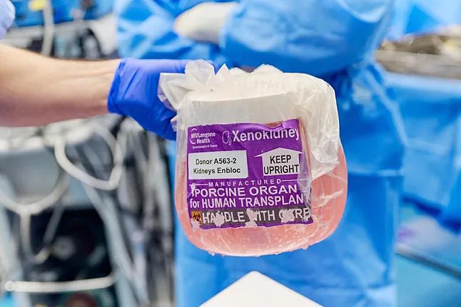Graft used in the first genetically modified kidney xenotransplantation.