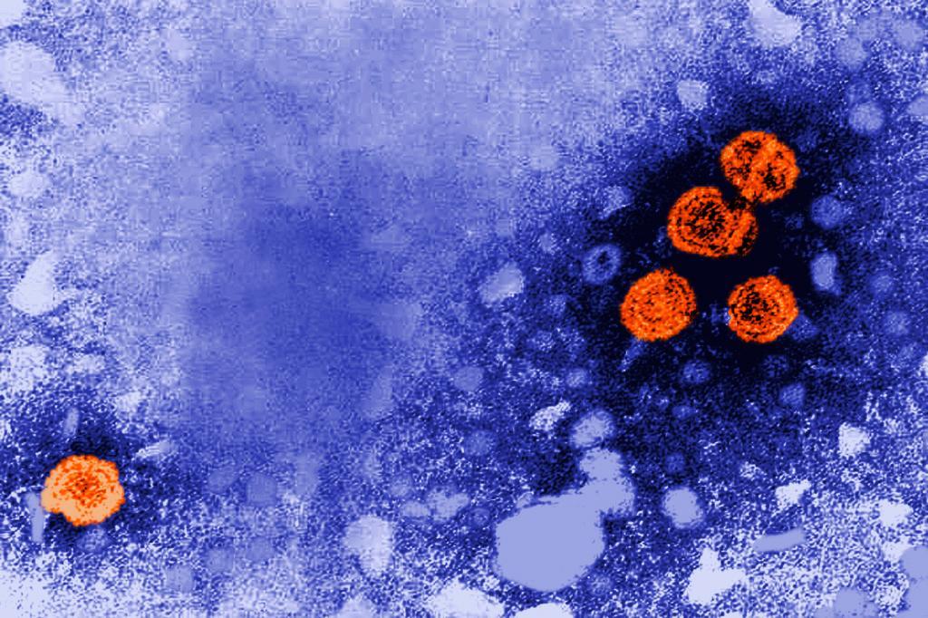 This 1981 electron microscope image made available by the U.S. Centers for Disease Control and Prevention shows hepatitis B virus particles
