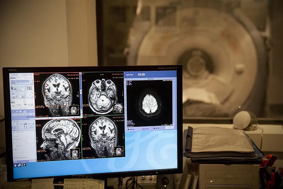 Magnetic resonance imaging with brain images of a patient.