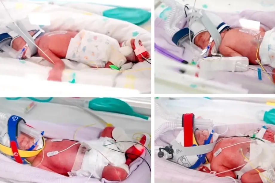 Image of the quadruplets born in Australia.