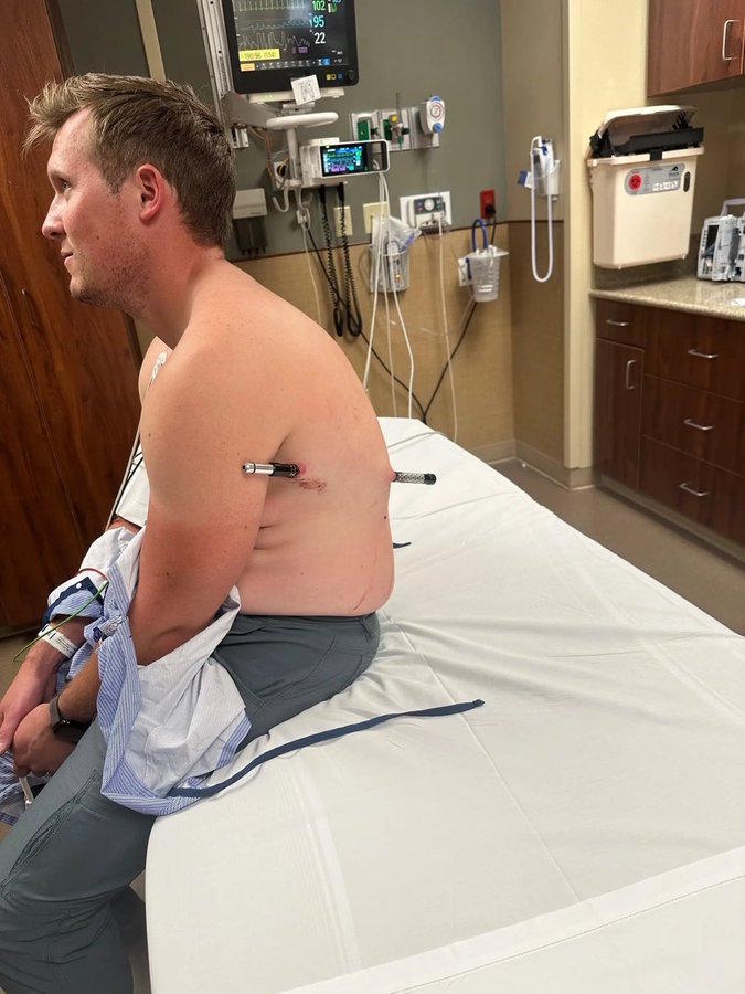 David Cifaldi fell onto one of his trekking poles, and it pierced his torso.