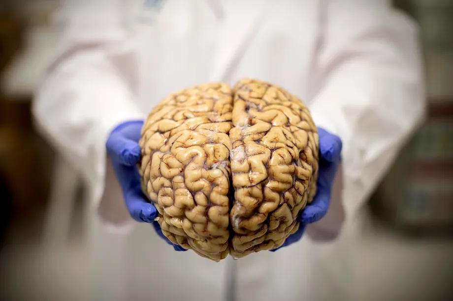 An organ donated to the Brain Bank of the CIEN Foundation.
