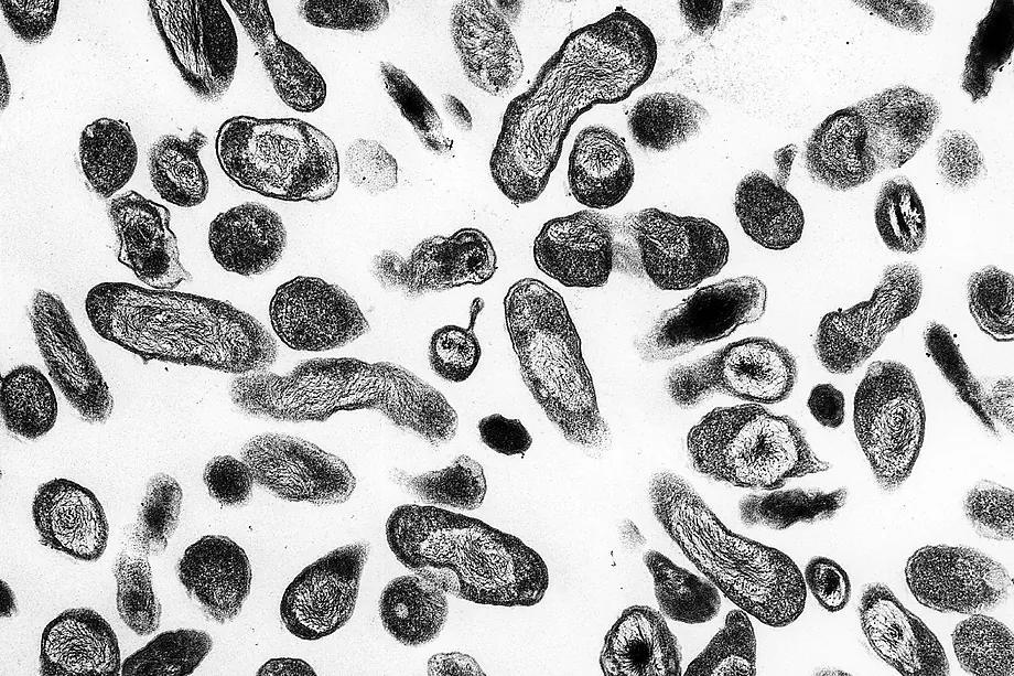 File image of a bacteria culture in a laboratory.
