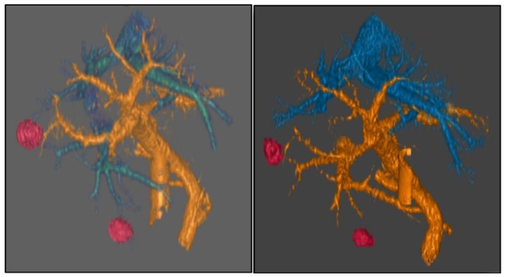The experimental approach was most effective at killing cancer cells with high replication stress